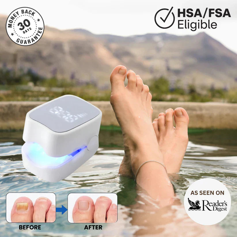 Swiftly™ - Nail Fungus Laser Device